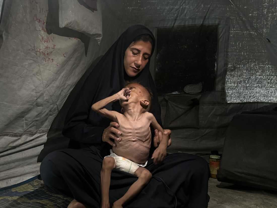 Hidayat Al-Motawaq holds her 18-month-old son, Mohammad Al-Motawaq, in their tent in the Gaza Strip on Aug. 3. Anas Baba/NPR